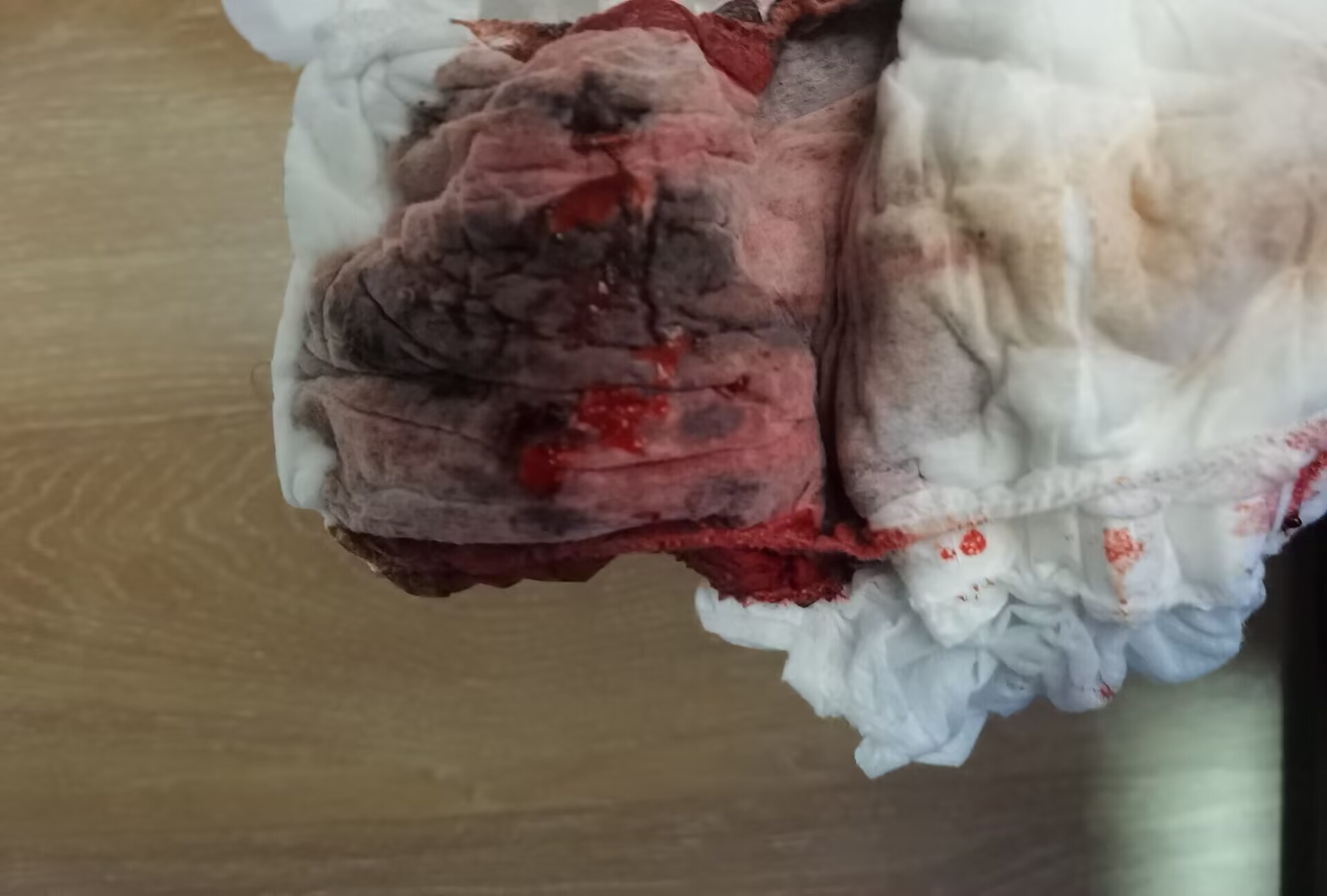 �������ҪʧѪ�����˰ɣ�����